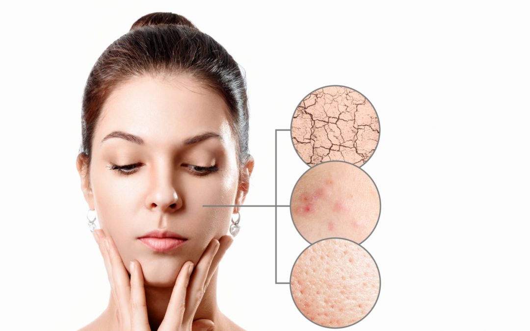 5 productos naturales para nutrir la piel corporal